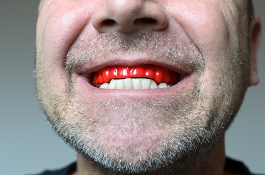 WHY YOU SHOULDN’T IGNORE TEETH GRINDING